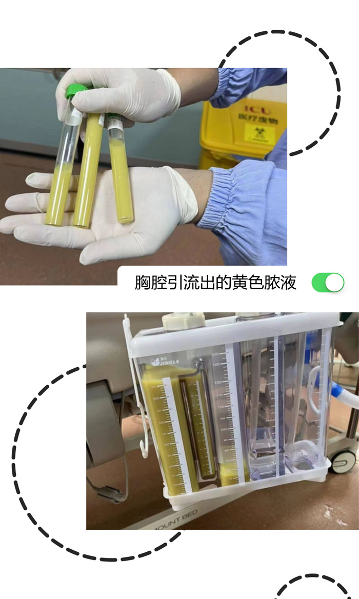 智齒1.jpg